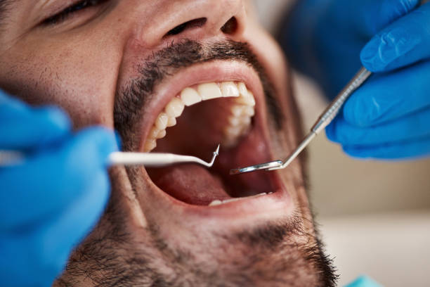 Best Tooth Pain Emergency Relief  in Lincoln Village, OH